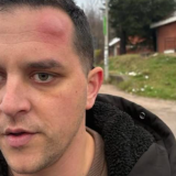 Poslanik ZLF koji je napadnut u Mionici: "Pribili su me uza zid i udarali šipkom" 7