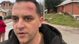 Poslanik ZLF koji je napadnut u Mionici: "Pribili su me uza zid i udarali šipkom" 4