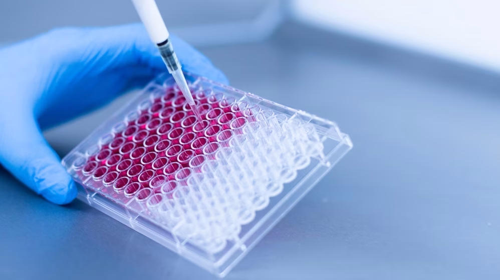 Nišlije danas daju matične ćelije za troje obolelih sugrađana 11