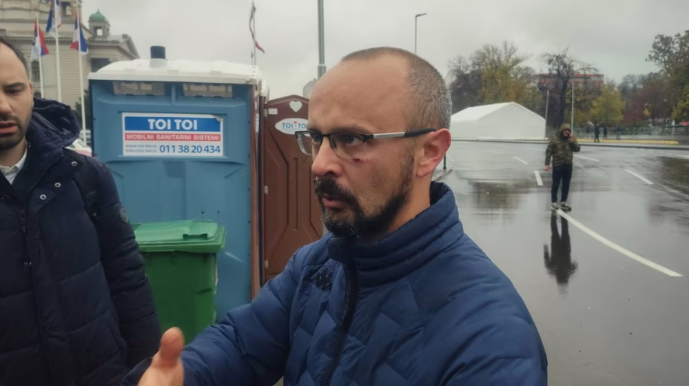 Napadnuti odbornik Kreni-Promeni Aleksnadar Jovanović FOTO: Kreni-Promeni