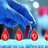 krvna grupa