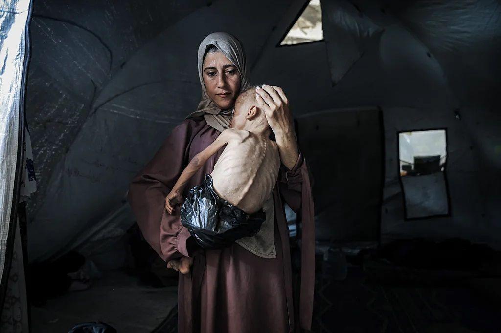 dete u gazi, izglednelo dete u gazi, majka drži mršavo dete u naručju u gazi