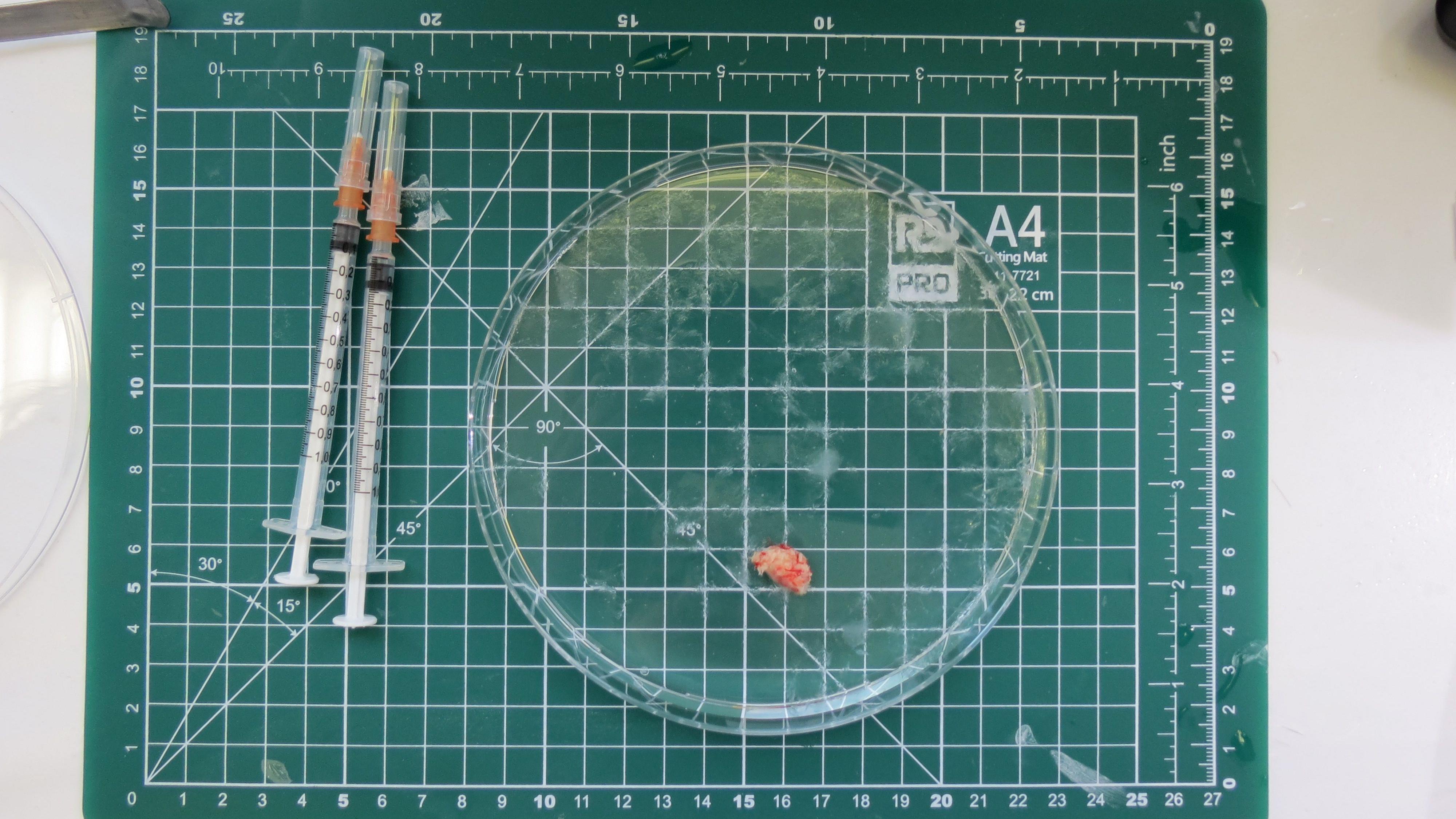 Zelena mrežasta podloga veličine A4 formata nalazi se u pozadini. Na njoj stoji okrugla, prozirna Petrijeva posuda. Unutra je grudvica crveno-belog moždanog tkiva, koja deluje zamućeno jer je još uvek uronjena u tečnost. Sa strane se nalaze dva šprica.