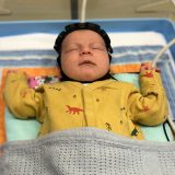 Revolucionarna kapa za mozak - nada za bebe rođene sa povredama 6