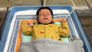 Revolucionarna kapa za mozak - nada za bebe rođene sa povredama 20 Revolucionarna kapa za mozak - nada za bebe rođene sa povredama 13