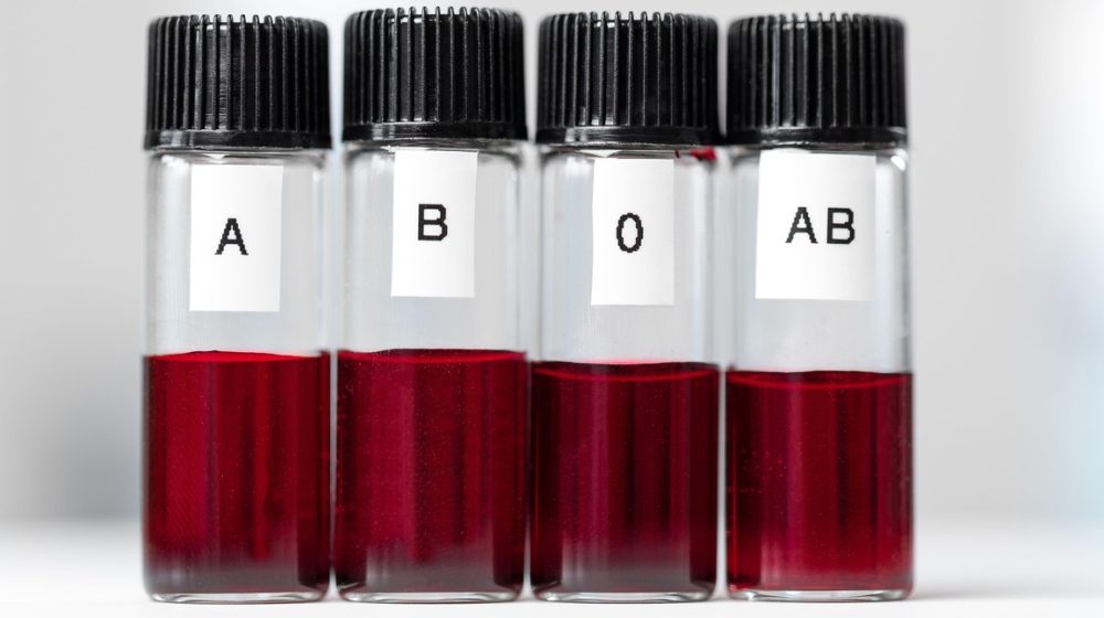 krvna grupa