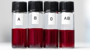 Vaša krvna grupa može uticati na rizik od ranog moždanog udara, otkriva studija 14 krvna grupa