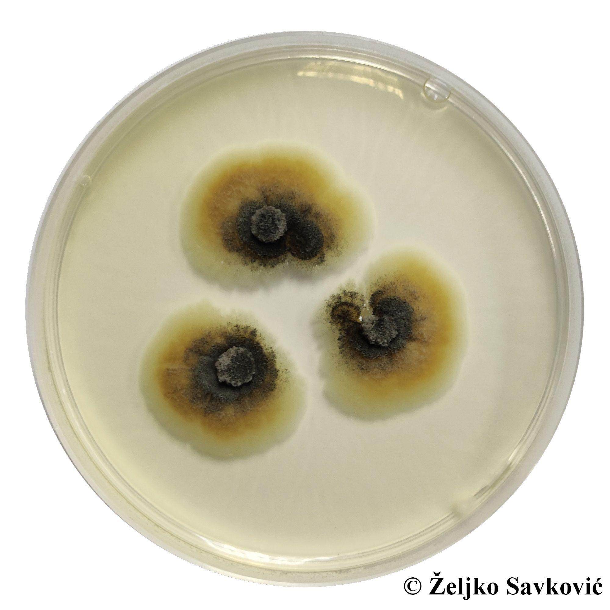 Mikroskopski prikaz nove vrste gljiva