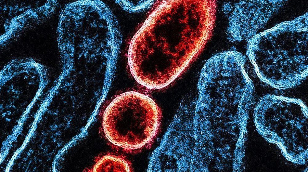 Šta je nipa virus i koliko je opasan 10