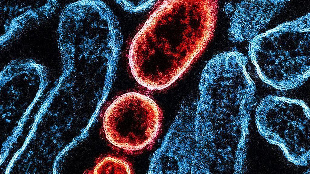Šta je nipa virus i koliko je opasan 1 Transmisiona elektronska mikrografija zrelih ekstracelularnih vezikula nipa virusa (crveno) blizu periferije zaražene Vero ćelije (plavo)