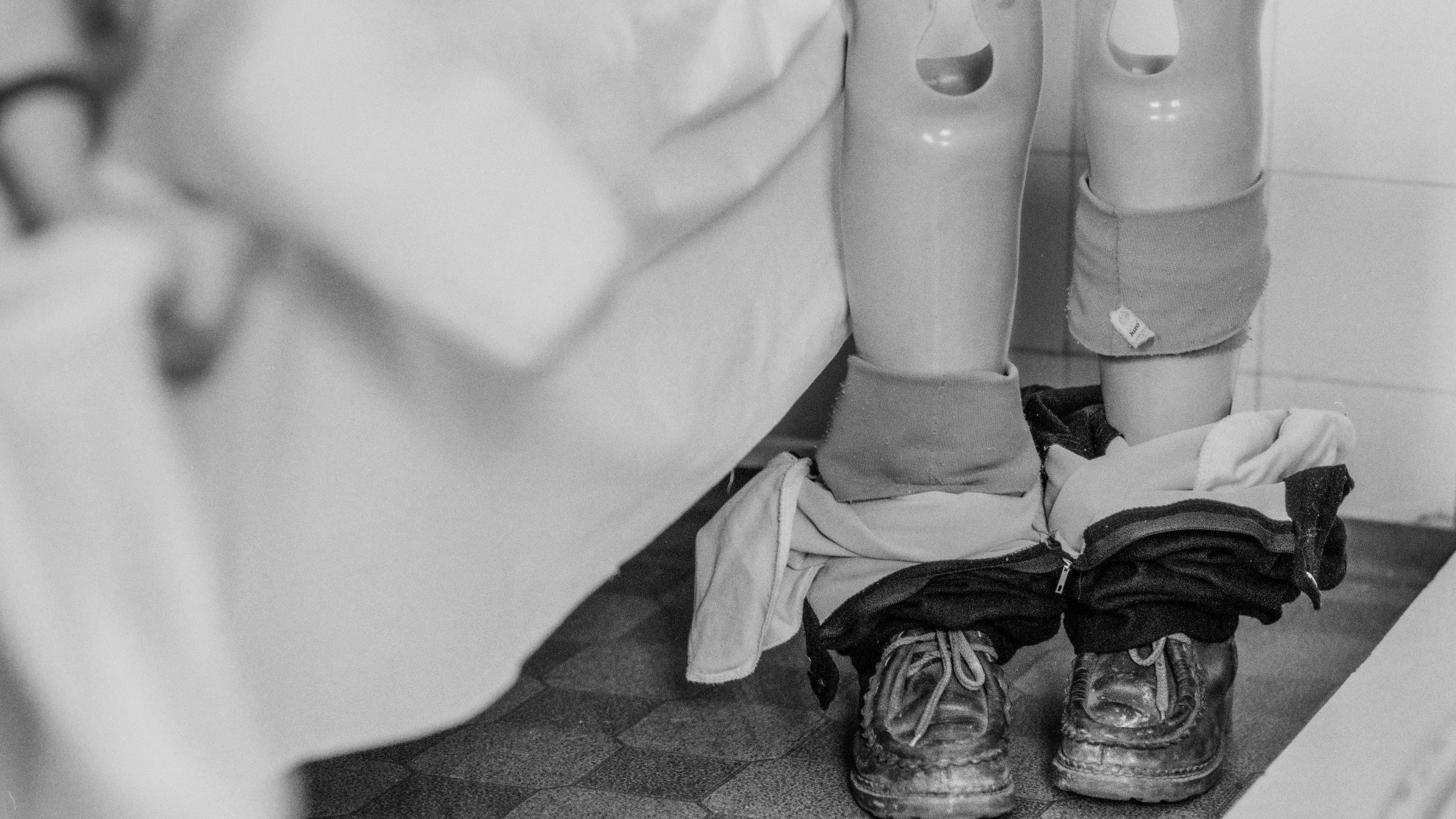 Kako odrastanje u ratu zaista utiče na jednog 11-godišnjaka 7 Crno-bela fotografija dečje protetike za noge