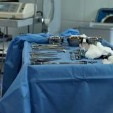 Još jedan smrtni slučaj zbog operacije krajnika u Čačku: Šta kaže Ministarstvo zdravlja? 5