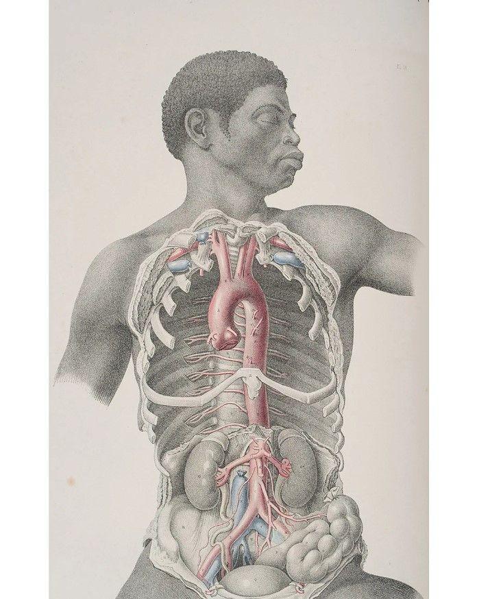 Minuciozni rad Maklisa uvršćen je u izložbu postavljenu u Tekerijevom muzeju medicine