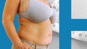 'Bilo me je mnogo sramota': Kako velike grudi mogu da utiču na zdravlje 23