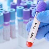 HPV
