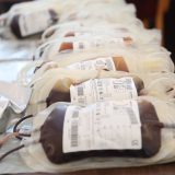 Institut: Nastavak akcije davanja krvi u Ulici Svetog Save 39 u Beogradu i na terenu 8