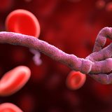 ebola
