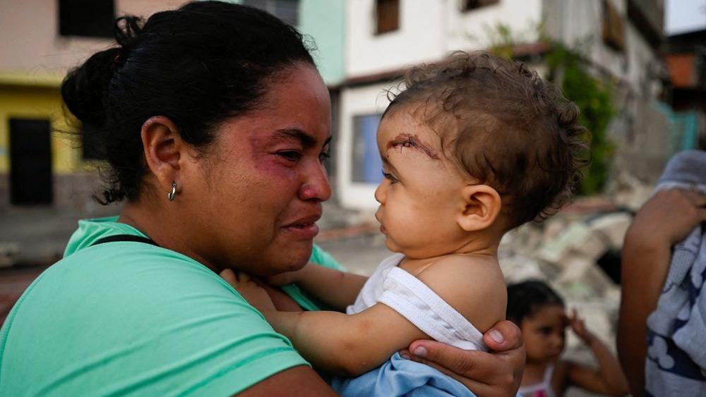 zemljotres u venecueli, žena drži u naručju dete povređeno u zemljotresu