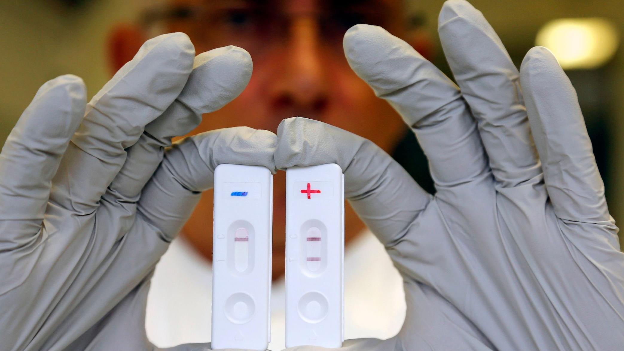 Prvi slučaj ebole u Francuskoj 1 Test na ebola virus - arhivska fotografija
