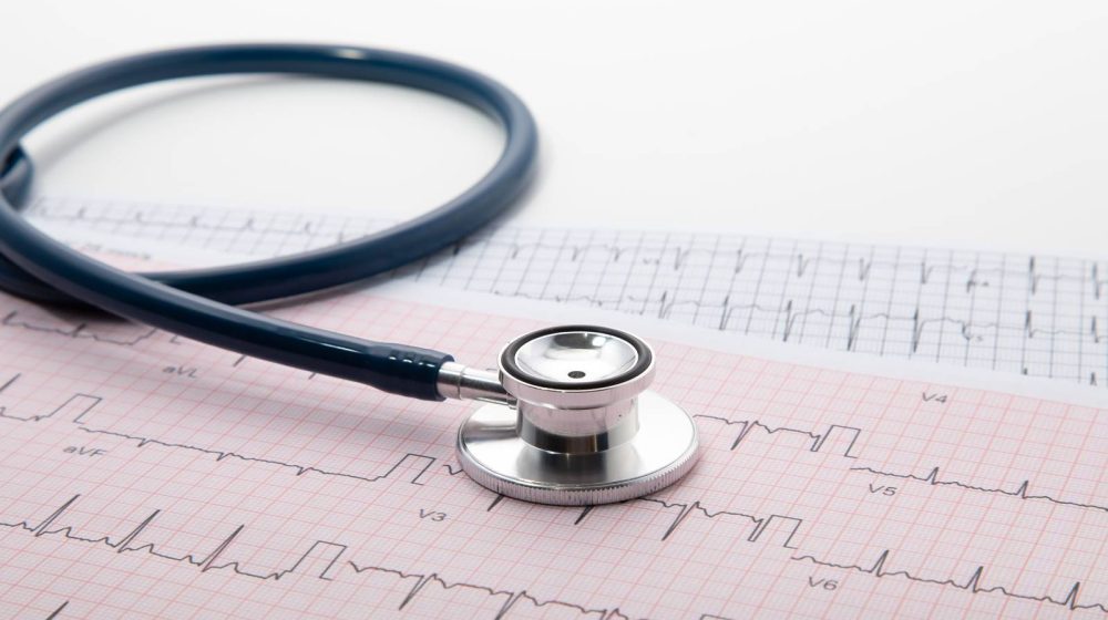 EKG