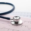 EKG