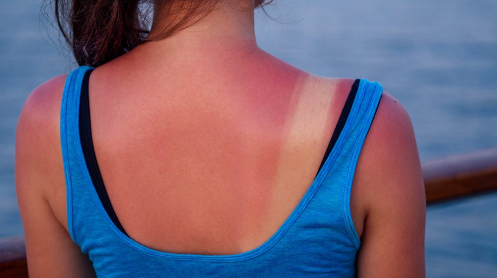 dermatolozi
