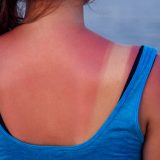dermatolozi