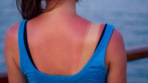 dermatolozi