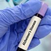Alchajmer